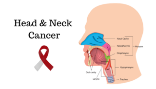 Best Head and Neck Cancer Surgeon